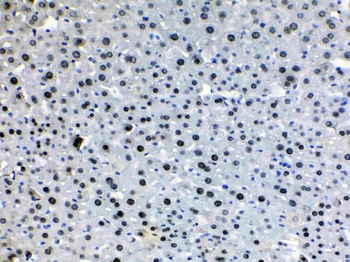 Anti-HDGF Antibody