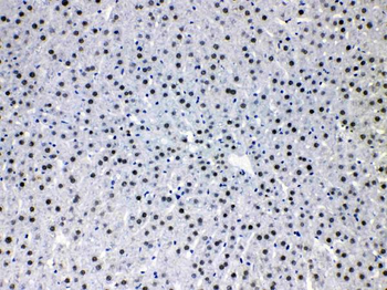 Anti-HDGF Antibody