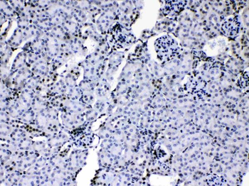 Anti-HnRNP A1/HNRNPA1 Antibody