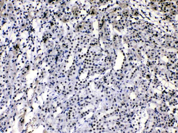 Anti-HnRNP A1/HNRNPA1 Antibody