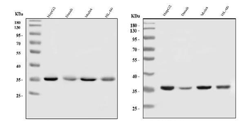 Anti-HnRNP A1/HNRNPA1 Antibody