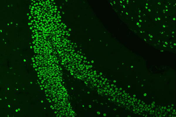 Anti-HnRNP A1/HNRNPA1 Antibody