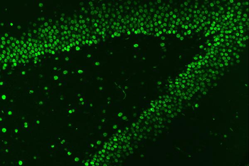 Anti-HnRNP A1/HNRNPA1 Antibody