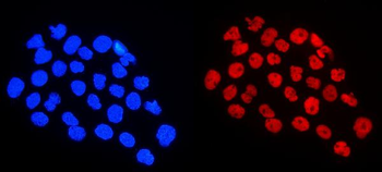 Anti-HnRNP A1/HNRNPA1 Antibody