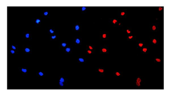Anti-HnRNP A1/HNRNPA1 Antibody