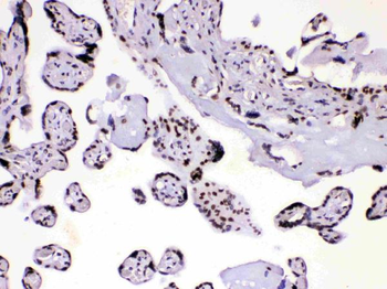 Anti-HnRNP A1/HNRNPA1 Antibody