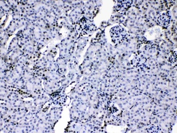 HnRNP A1/HNRNPA1 Antibody