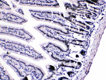 Anti-HnRNP A1/HNRNPA1 Antibody