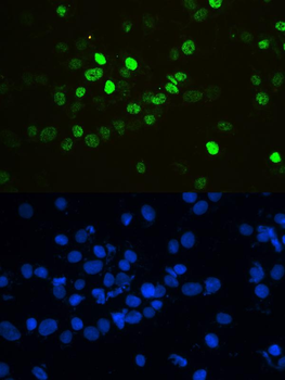 Anti-HnRNP F/HNRNPF Antibody