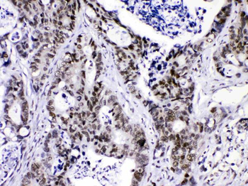 Anti-HnRNP F/HNRNPF Antibody