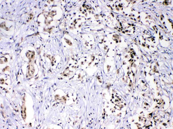 Anti-HnRNP F/HNRNPF Antibody