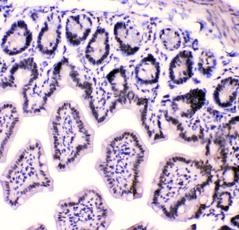 Anti-HnRNP F/HNRNPF Antibody