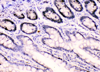 Anti-HnRNP F/HNRNPF Antibody