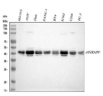 Anti-HnRNP F/HNRNPF Antibody