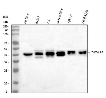 Anti-HnRNP F/HNRNPF Antibody