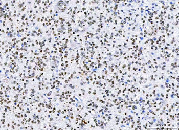 Anti-HnRNP H/HNRNPH1 Antibody