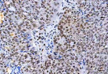 Anti-HnRNP H/HNRNPH1 Antibody