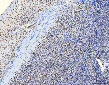 Anti-HnRNP H/HNRNPH1 Antibody