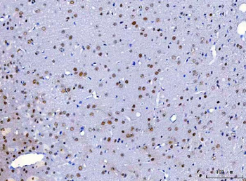 Anti-HnRNP H/HNRNPH1 Antibody