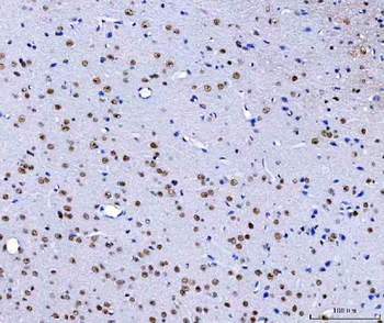 Anti-HnRNP H/HNRNPH1 Antibody