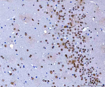 Anti-HnRNP H/HNRNPH1 Antibody