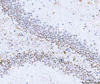 Anti-HnRNP H/HNRNPH1 Antibody