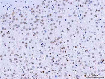 Anti-HnRNP H/HNRNPH1 Antibody