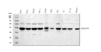 HnRNP H/HNRNPH1 Antibody