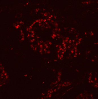 Anti-HnRNP H/HNRNPH1 Antibody