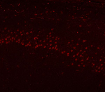 Anti-HnRNP H/HNRNPH1 Antibody