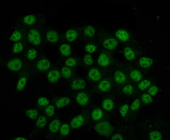 Anti-HnRNP H/HNRNPH1 Antibody