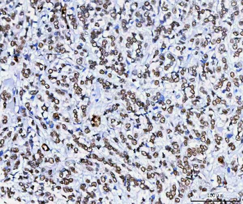 Anti-HnRNP H/HNRNPH1 Antibody