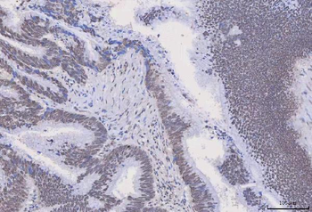 Anti-HnRNP H/HNRNPH1 Antibody
