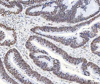 Anti-HnRNP H/HNRNPH1 Antibody
