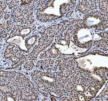 Anti-HnRNP L/HNRNPL Antibody