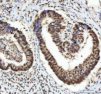 Anti-HnRNP L/HNRNPL Antibody