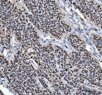 Anti-HnRNP L/HNRNPL Antibody