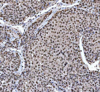 Anti-HnRNP L/HNRNPL Antibody