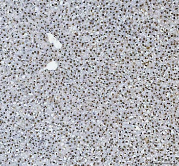 Anti-HnRNP L/HNRNPL Antibody