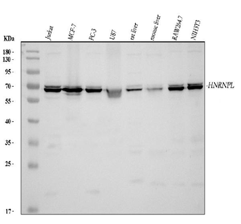 Anti-HnRNP L/HNRNPL Antibody
