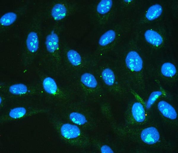 IKK gamma/IKBKG Rabbit Polyclonal Antibody