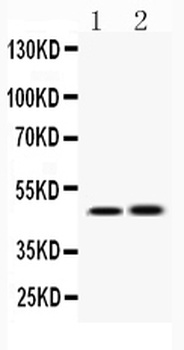 IKK gamma/IKBKG Antibody