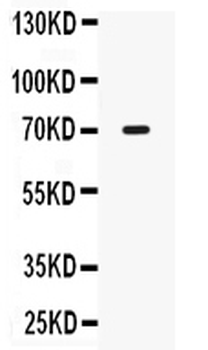 IL12RB1 Antibody
