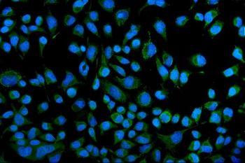 Anti-KCNQ1 Antibody