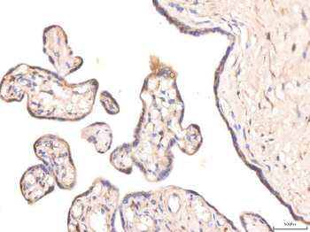 Anti-KCNQ1 Antibody