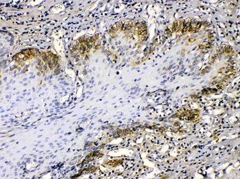 Anti-Cytokeratin 14/KRT14 Antibody