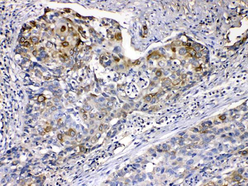 Anti-Cytokeratin 14/KRT14 Antibody