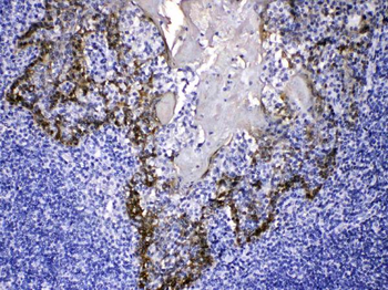 Anti-Cytokeratin 14/KRT14 Antibody