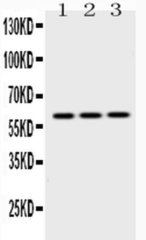 Anti-Cytokeratin 14/KRT14 Antibody