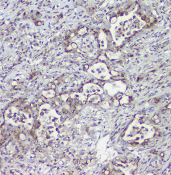 Anti-Mannose Phosphate Isomerase/MPI Antibody